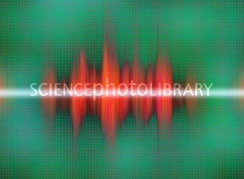 Sound Byte